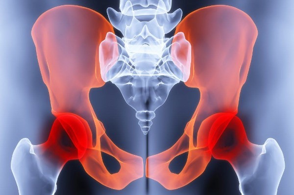 Артрит тазобедренного сустава – симптомы и лечение болезни